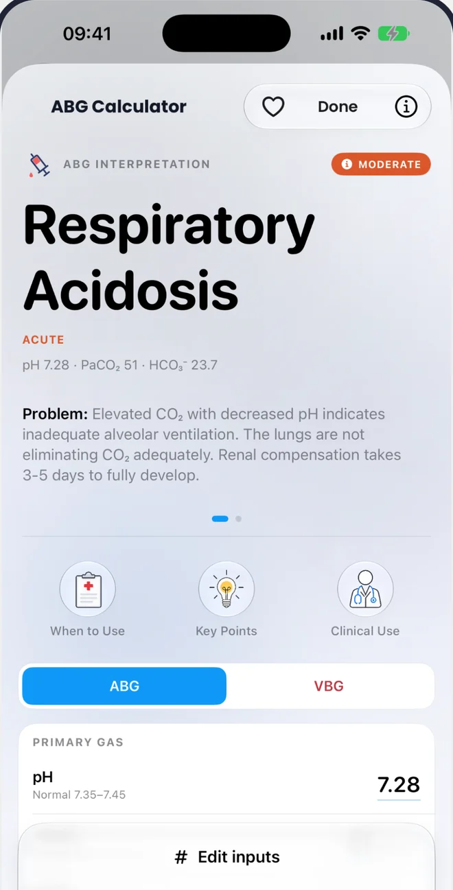 ABG calculator interpreting pH 7.28, PaCO2 51 and HCO3 23.7 as acute respiratory acidosis
